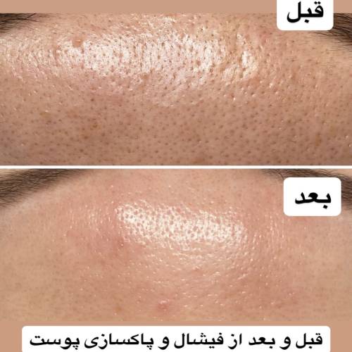 نمونه خدمات فشیال کلینیک دکتر دریاباری (کلینیک زیبایی هروی)