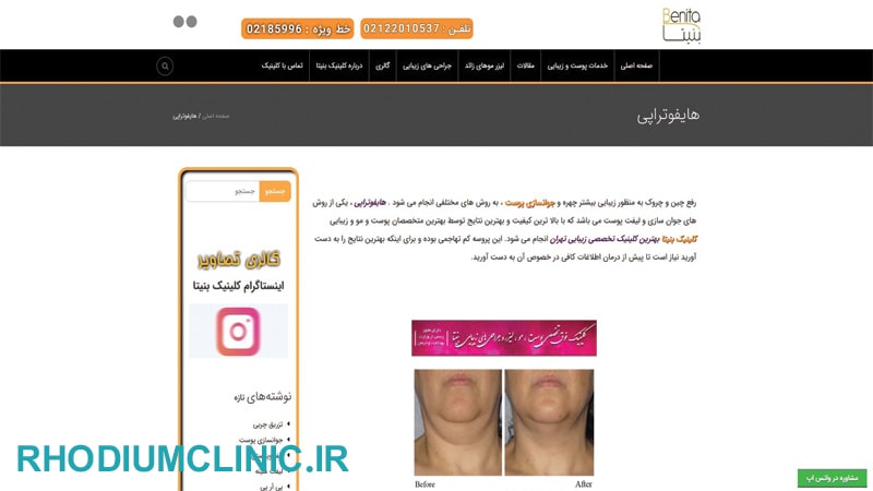 مرکز هایفوتراپی بنیتا