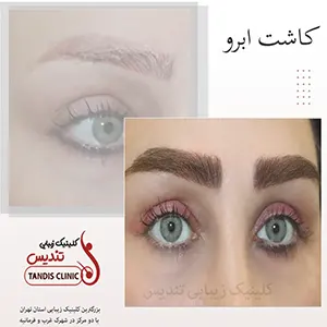 نمونه خدمات کلینیک تندیس