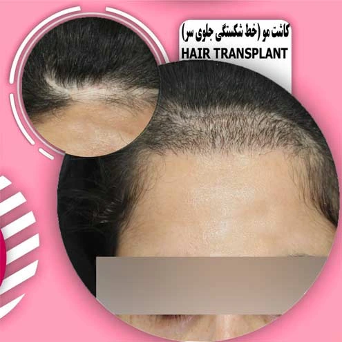 نمونه کار آسمان آبی 2