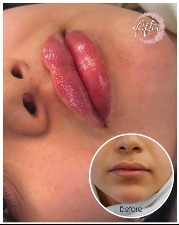 نمونه کار آنسه