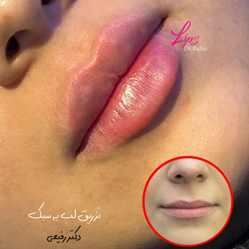 نمونه کار دکتر علیرضا رفیعی