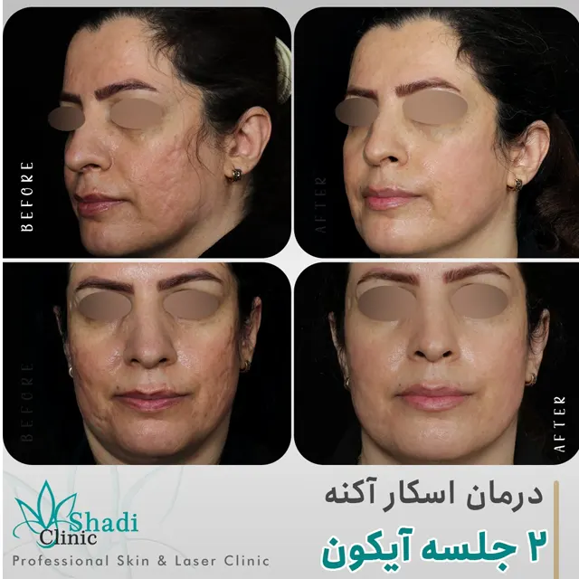 نمونه کار شادی مظلومی 
