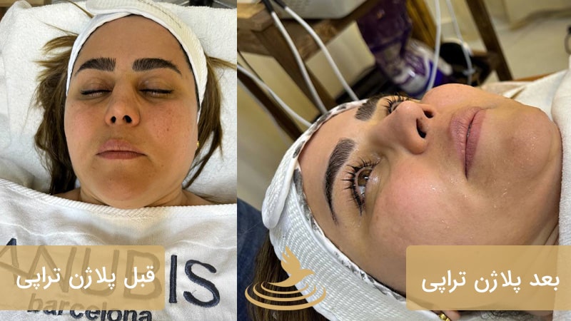 نمونه کار فیشیال دکتر فاخته 2