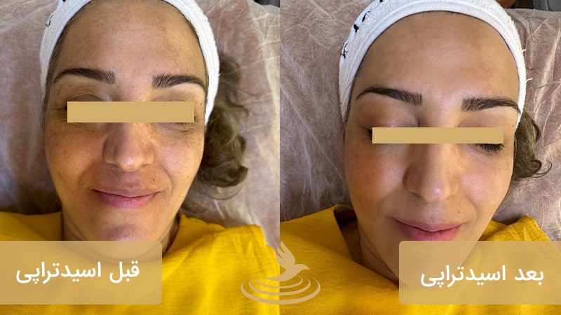 نمونه کار فیشیال دکتر فاخته 3