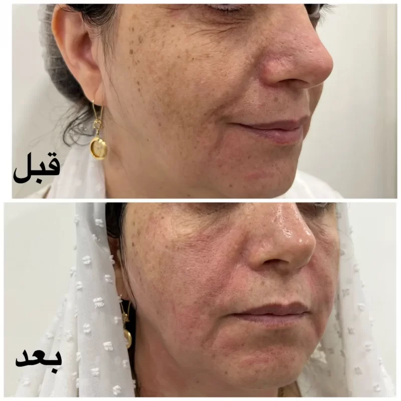 نمونه کار نیوشا 2