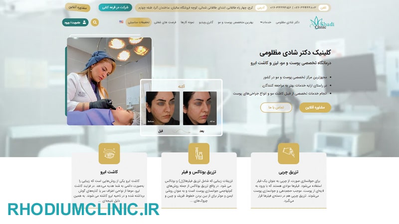 کلینیک درمان ریزش مو دکتر شادی مظلومی کرج