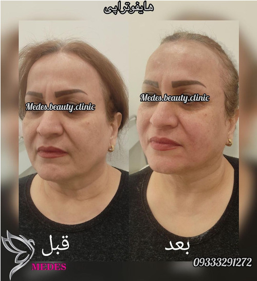 نمونه مدس