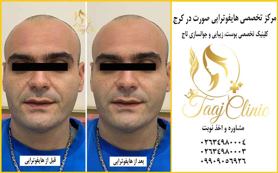 نمونه کار هایفو کلینیک تاج 2