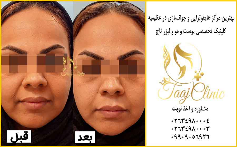 نمونه کار هایفو کلینیک تاج