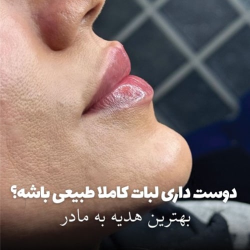دکتر ساره معماری نمونه کار