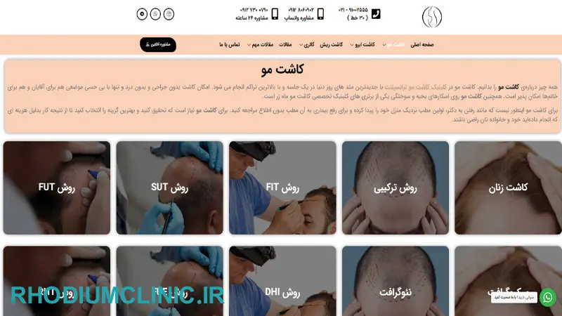 مرکز کاشت مو ماه زر در تهران