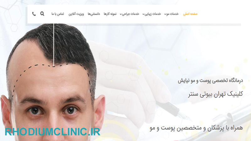 کلینیک کاشت مو نیایش در تهران