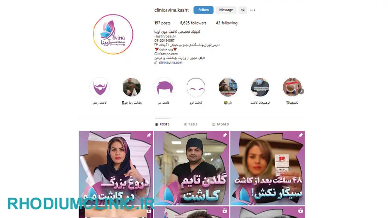 آوینا، بهترین مرکز کاشت ابرو در کرج