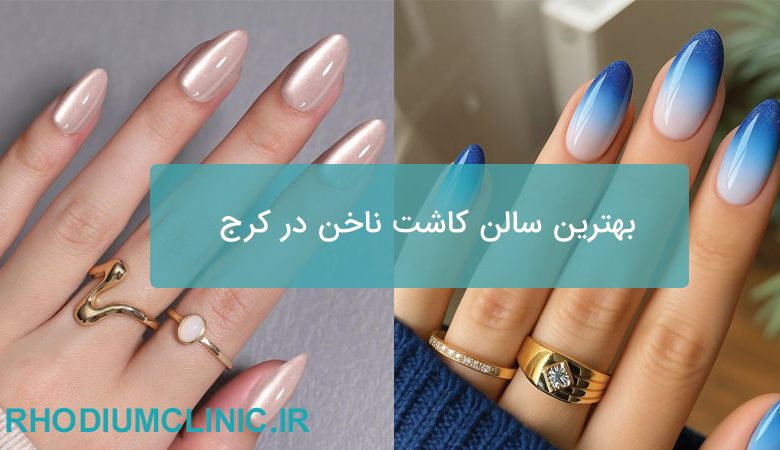 بهترین سالن کاشت ناخن در کرج