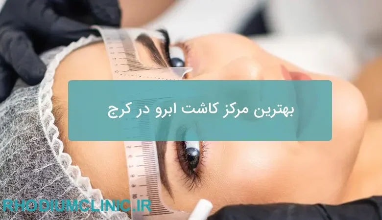 بهترین مرکز کاشت ابرو در کرج