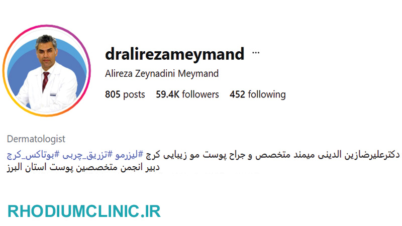 تزریق بوتاکس توسط دکتر علیرضا میمند