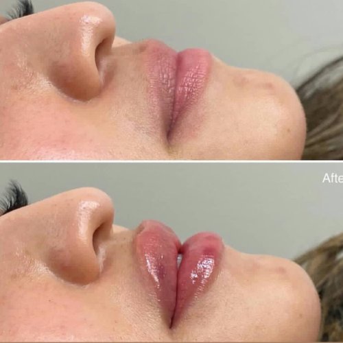 بهترین مرکز تزریق ژل کرج