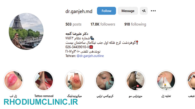 دکتر علیرضا گنجه، بهترین دکتر تزریق ژل لب در کرج