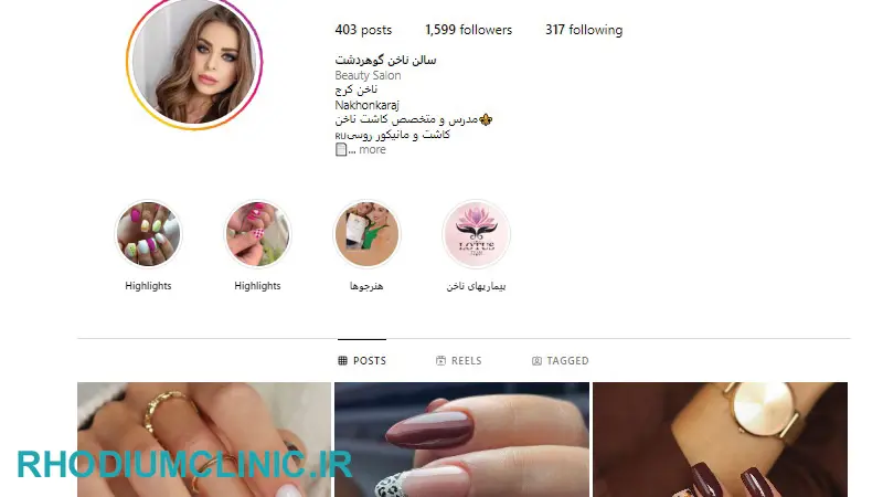 سالن کاشت ناخن لوتوس در کرج