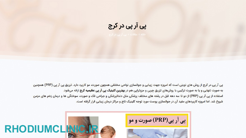 مرکز prp تاج در کرج