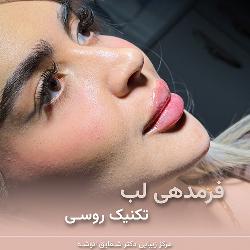 خدمات تزریق ژل در کلینیک دکتر انوشه؛ بهترین کلینیک زیبایی در مهرشهر