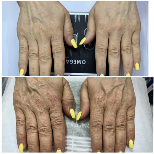 نمونه کارهای فیشال در مجموعه روژین اسکین کر