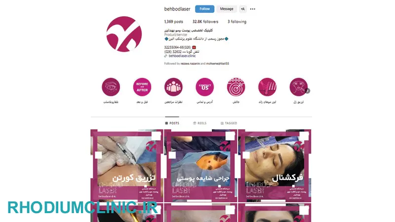 کاشت ابرو در کلینیک بهبد کرج