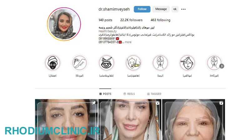 کاشت ابرو در کلینیک دکتر شمیم ویسه کرج