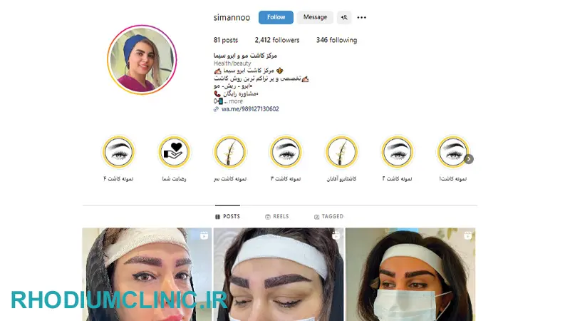 کاشت ابرو در کلینیک سیما در کرج