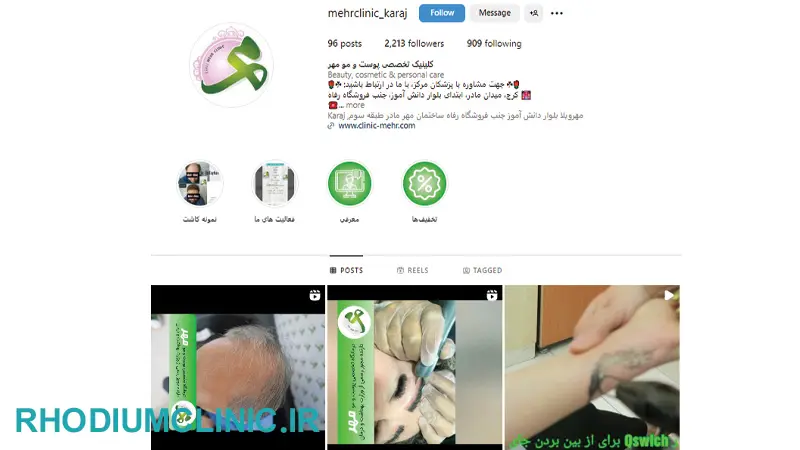 کاشت ابرو در کلینیک مهر در کرج