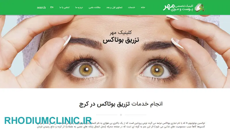کلینیک بوتاکس مهر در کرج