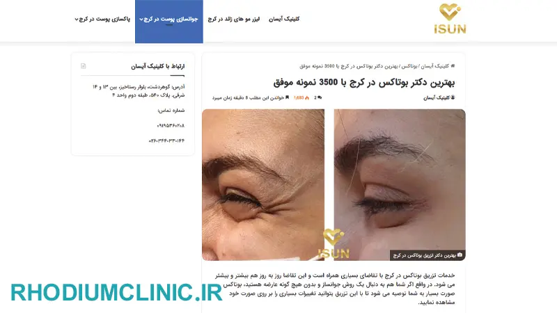 کلینیک تخصصی تزریق بوتاکس آیسان در کرج