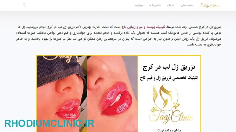 کلینیک تزریق ژل تاج در کرج