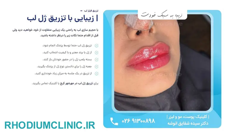 کلینیک تزریق ژل دکتر انوشه در کرج