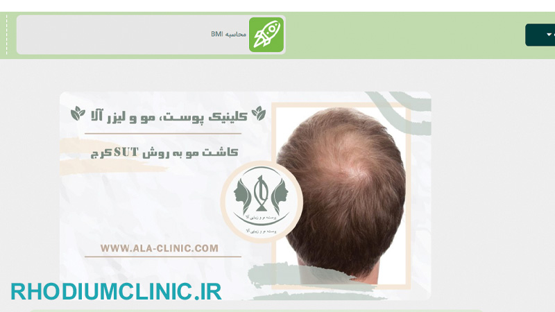 آلا، بهترین مرکز کاشت مو کرج