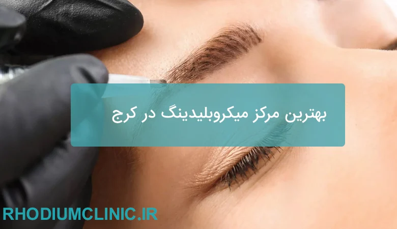 بهترین مرکز میکروبلیدینگ در کرج