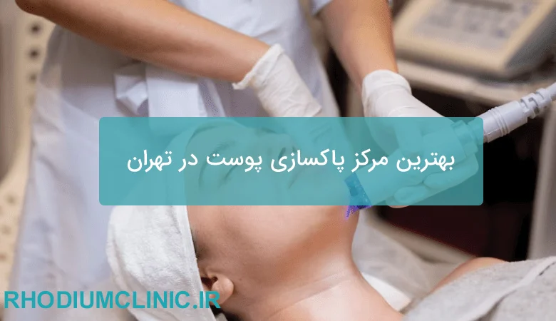 بهترین مرکز پاکسازی پوست در تهران