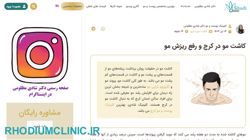 دکتر شادی مظلومی، بهترین دکتر کاشت مو کرج