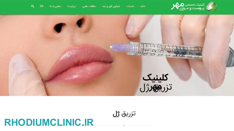 مرکز تزریق فیلر مهر در کرج