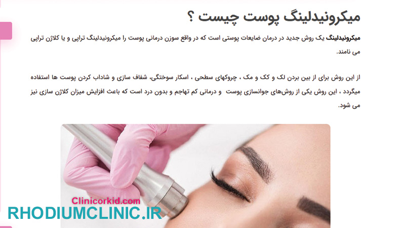 مرکز میکرونیدلینگ ارکید در تهران