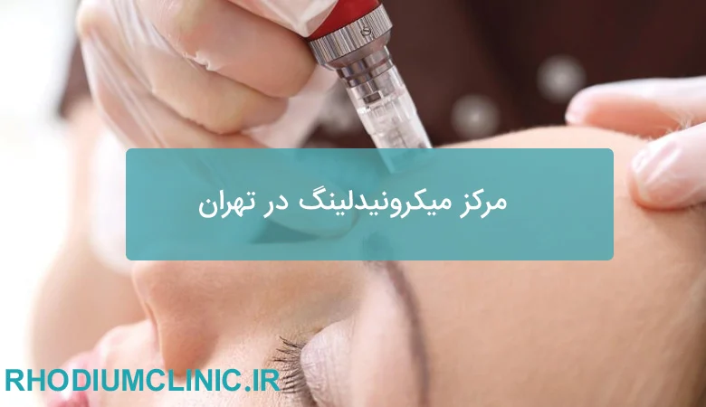 مرکز میکرونیدلینگ در تهران