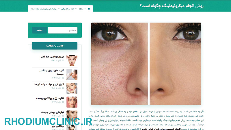 مرکز میکرونیدلینگ شهرزاد در کرج