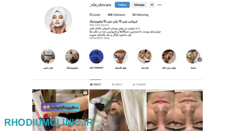 مرکز کربوکسی تراپی نیلا در کرج