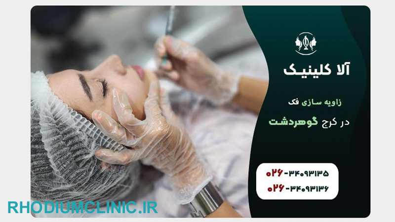 کانتورینگ و زاویه سازی صورت در کلینیک آلا کرج