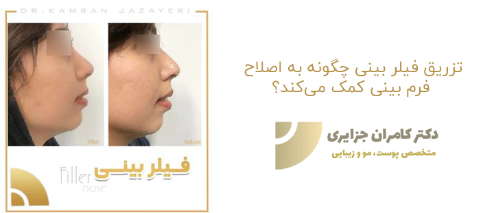 کلینیک تزریق فیلر دکتر کامران جزایری در تهران