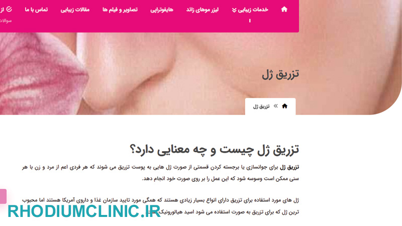کلینیک تزریق ژل ارکید در تهران