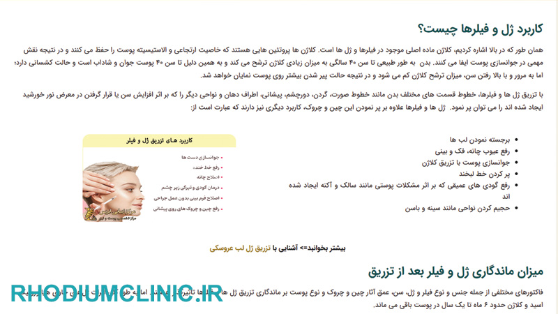 کلینیک تزریق ژل ایریس در تهران