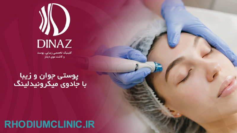 کلینیک میکرونیدلینگ دیناز در تهران