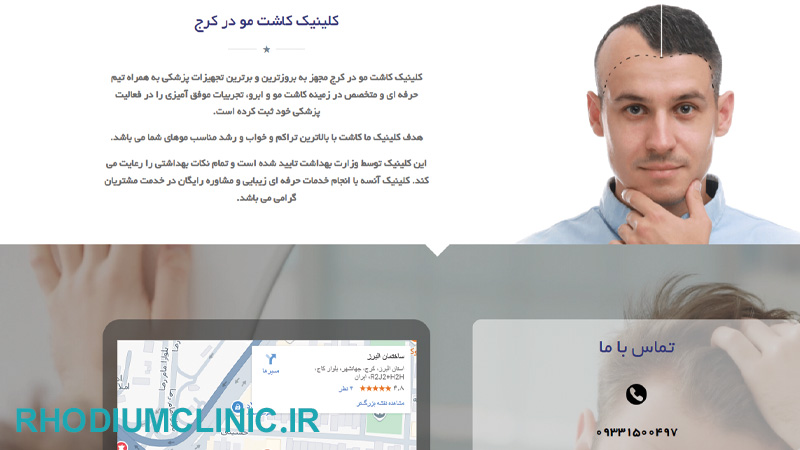 کلینیک کاشت مو آنسه در کرج
